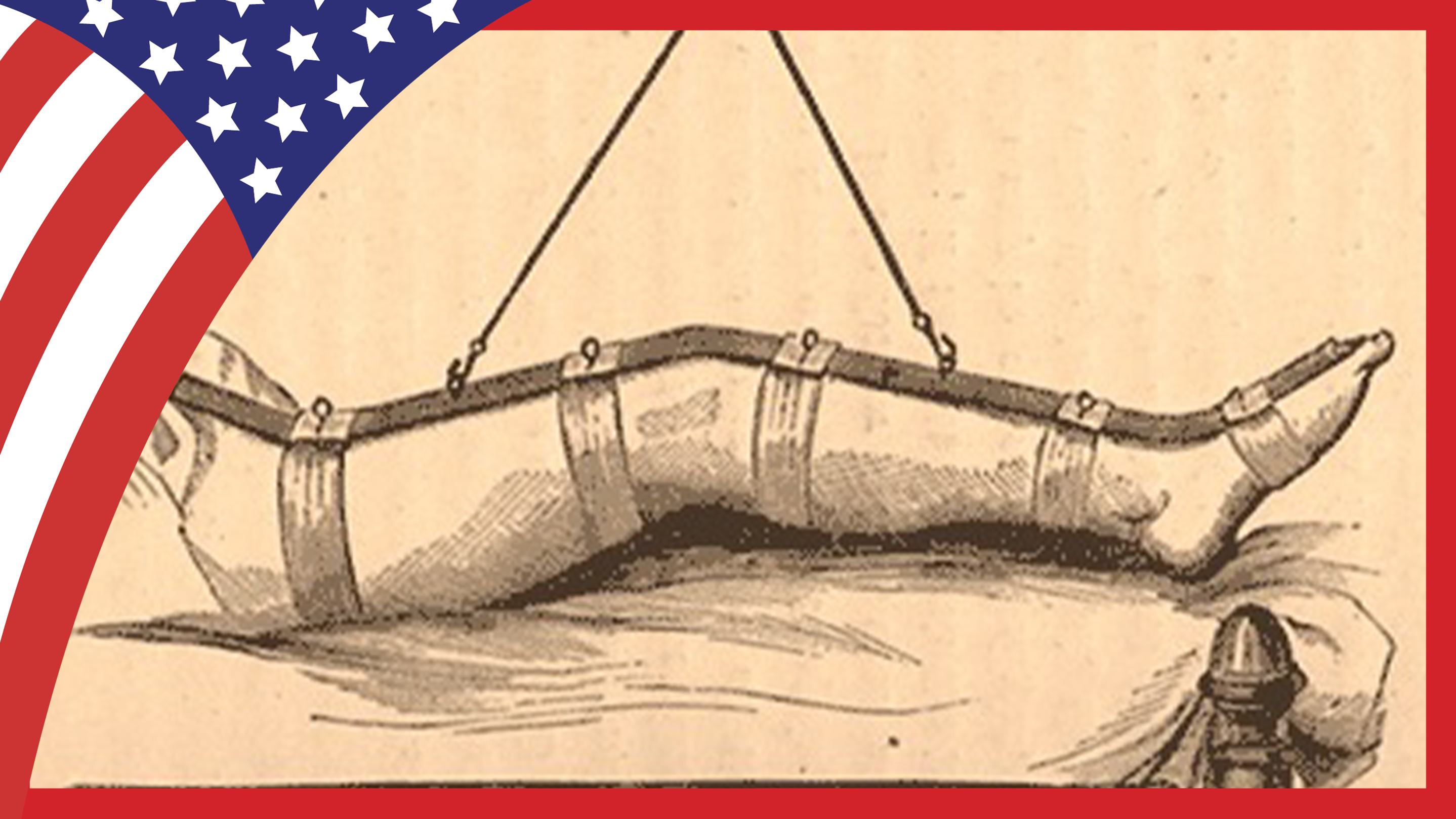 The title page of a dissertation that begins "An Inaugural Dissertation on Wounds of Femur" from the Civil War era.