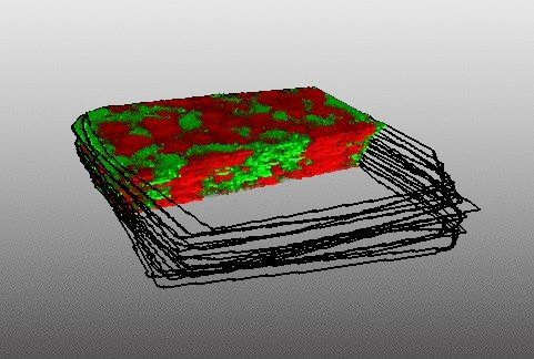 3D mapping of bacterial lipid virulence factor (green) and host lipid response (red) in mouse spleen.