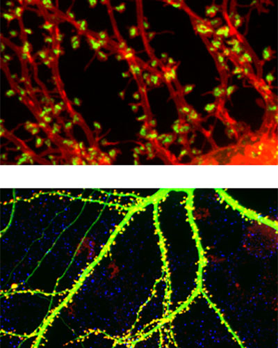 Synapses visualized in live neurons. The overall structure of one cell in a dense network of interconnected neurons is visible from expression of a red and green fluorescent protein that fills that cell entirely.